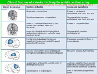 Clinical features of a stroke involving the middle cerebral artery.
(From Weyhenmeyer, J, Gallman, E: Neuroscience, Rapid Review Series, 1st edition, 2007, Philadelphia, Mosby, p 28, Table 3-1.)
 
