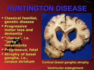 HUNTINGTON DISEASEHUNTINGTON DISEASE
Classical familial,Classical familial,
genetic diseasegenetic disease
ProgressiveProgressive
motor loss andmotor loss and
dementiadementia
““chorea”, i.e.chorea”, i.e.
“jerky”“jerky”
movementsmovements
Progressive, fatalProgressive, fatal
Atrophy of basalAtrophy of basal
ganglia, i.e.,ganglia, i.e.,
corpus striatumcorpus striatum Cortical (basal ganglia) atrophyCortical (basal ganglia) atrophy
Ventricular enlargementVentricular enlargement
 
