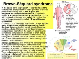 Brown-Séquard syndrome
In the spinal cord, segregation of fiber tracts and the
somatotopic arrangement of fibers give rise to distinct
patterns of sensory loss. Loss of pain and
temperature sensation on one side of the body
and of proprioception on the opposite side occurs
with lesions that involve one half of the cord on the
side of the proprioceptive deficit (Brown-Séquard
syndrome).
Compression of the upper spinal cord causes loss of
pain, temperature, and touch sensation first in
the legs, because the leg spinothalamic fibers are
most superficial. More severe cord compression
compromises fibers from the trunk. In patients with
spinal cord compression, the lesion is often above
the highest dermatome involved in the deficit. Thus,
radiographic studies should be tailored to visualize
the cord at and above the level of the sensory deficit
detected on examination.
Intrinsic cord lesions that involve the central portions
of the cord often impair pain and temperature
sensation at the level of the lesion because the fibers
crossing the anterior commissure and entering the
spinothalamic tracts are most centrally situated.
Thus, enlargement of the central cervical canal in
syringomyelia typically causes loss of pain and
temperature sensation across the shoulders and
upper arms.
 