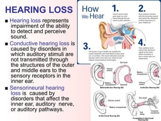 HEARING LOSS
■ Hearing loss represents
impairment of the ability
to detect and perceive
sound.
■ Conductive hearing loss is
caused by disorders in
which auditory stimuli are
not transmitted through
the structures of the outer
and middle ears to the
sensory receptors in the
inner ear.
■ Sensorineural hearing
loss is caused by
disorders that affect the
inner ear, auditory nerve,
or auditory pathways.
 