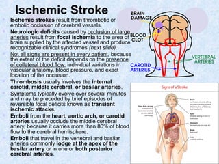 Pathophysiology of cns II 2013 | PPT