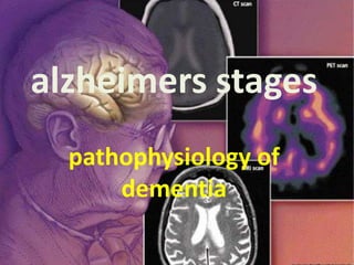 alzheimers stages
  pathophysiology of
      dementia
 