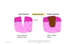 PATHOPHYSIOLOGY OF HEALING WITH PRIMARY & SECONDARY INTENTION.pptx