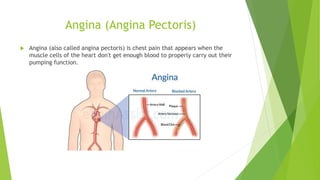 Pathophysiology of heart | PPTX
