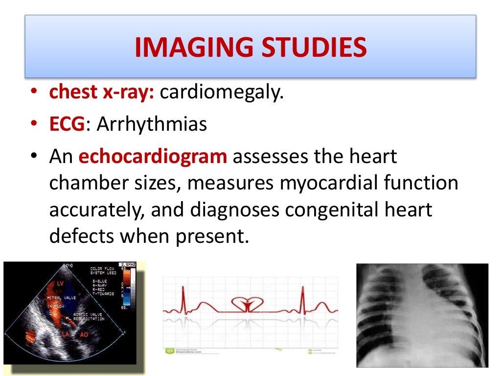 Heart failure in Pediatrics (pathophysiology)