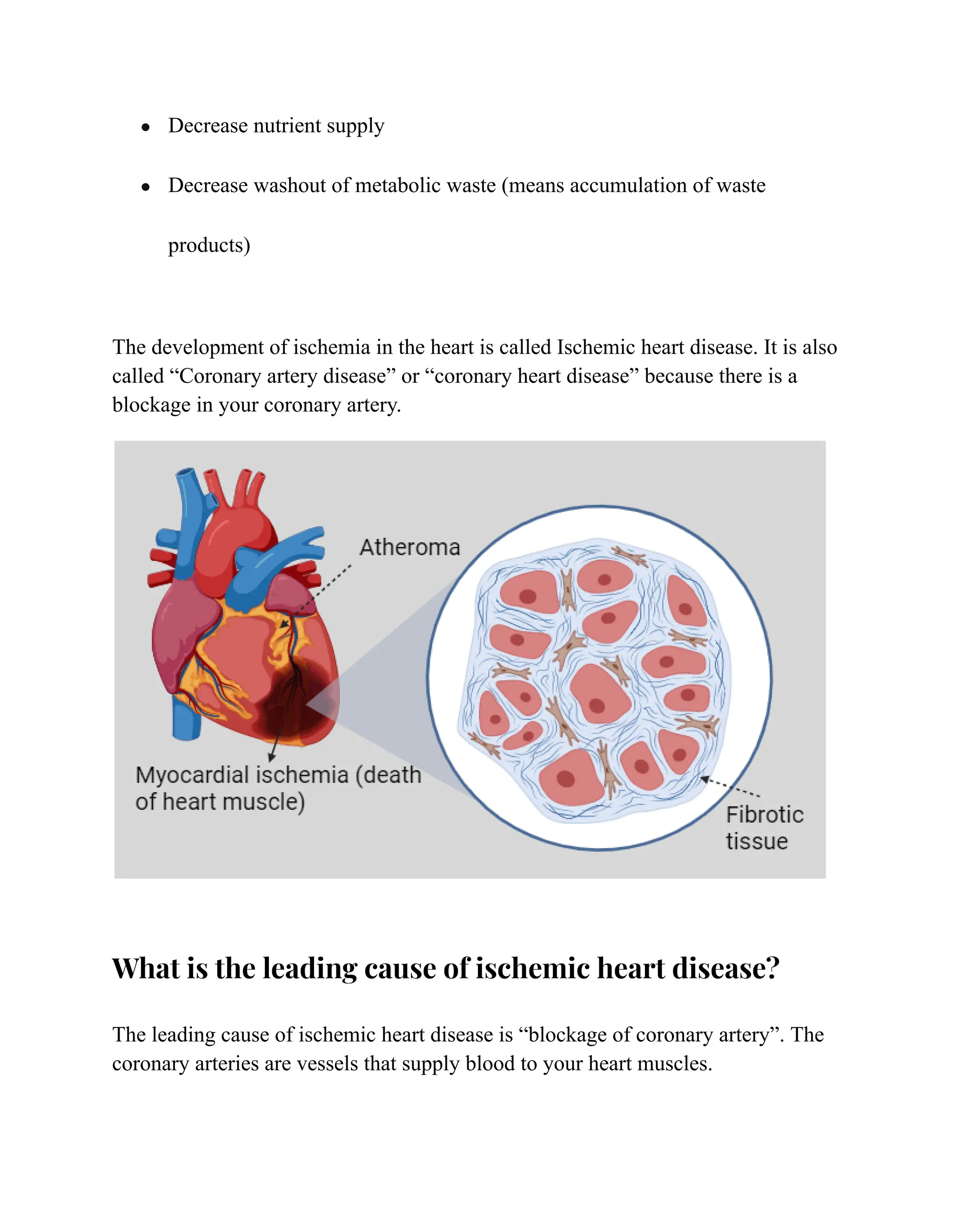 ● Decrease nutrient supply
● Decrease washout of metabolic waste (means accumulation of waste
products)
The development of ischemia in the heart is called Ischemic heart disease. It is also
called “Coronary artery disease” or “coronary heart disease” because there is a
blockage in your coronary artery.
What is the leading cause of ischemic heart disease?
The leading cause of ischemic heart disease is “blockage of coronary artery”. The
coronary arteries are vessels that supply blood to your heart muscles.
 