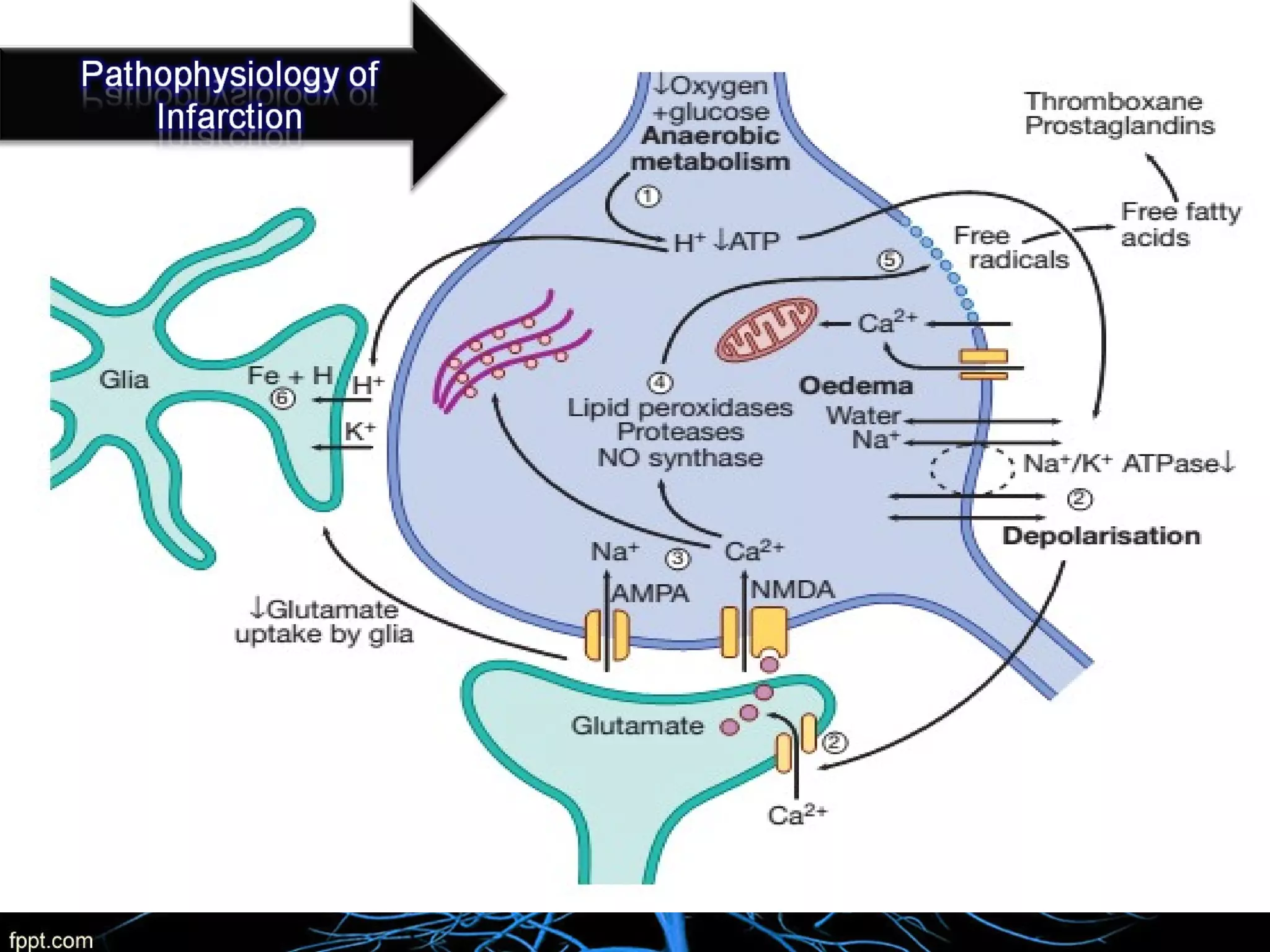 Basic Anatomy & Pathophysiology of ischemic stroke | PPT