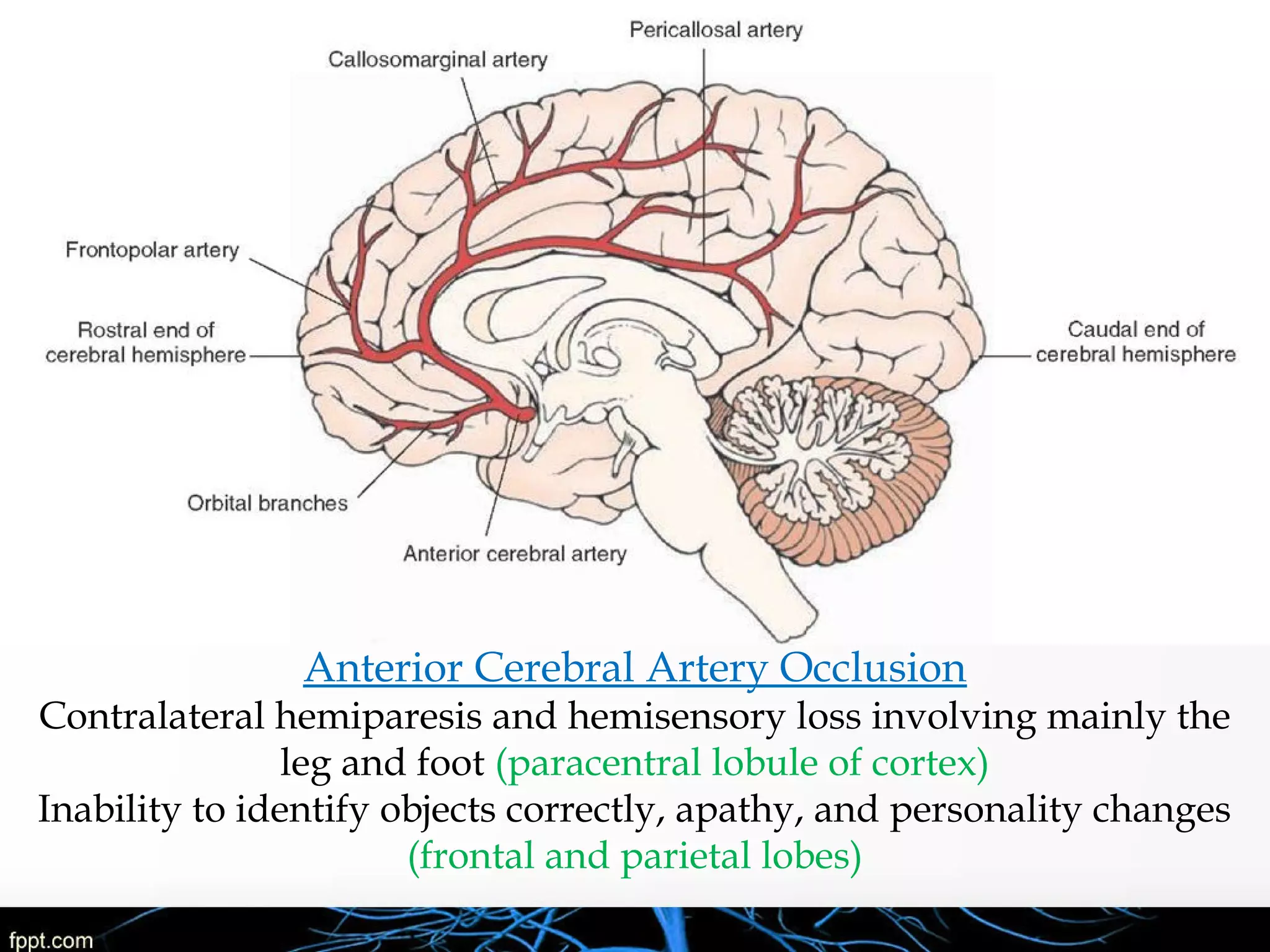 Basic Anatomy & Pathophysiology of ischemic stroke | PPT