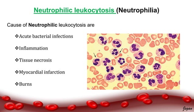 Pathophysiology of leukocytosis