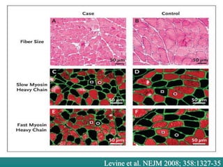 St. Michael’s Hospital
            A teaching hospital affiliated with the University of Toronto




Levine et al. NEJM 2008; 358:1327-35
 