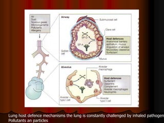 Lung host defence mechanisms the lung is constantly challenged by inhaled pathogen
Pollutants an particles
 
