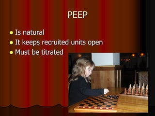 PEEP
 Is natural
 It keeps recruited units open
 Must be titrated
 