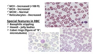 Normal Howell PATHOPHYSIOLOGY OF MEGALOBLSTIC ANEMIA.pptx