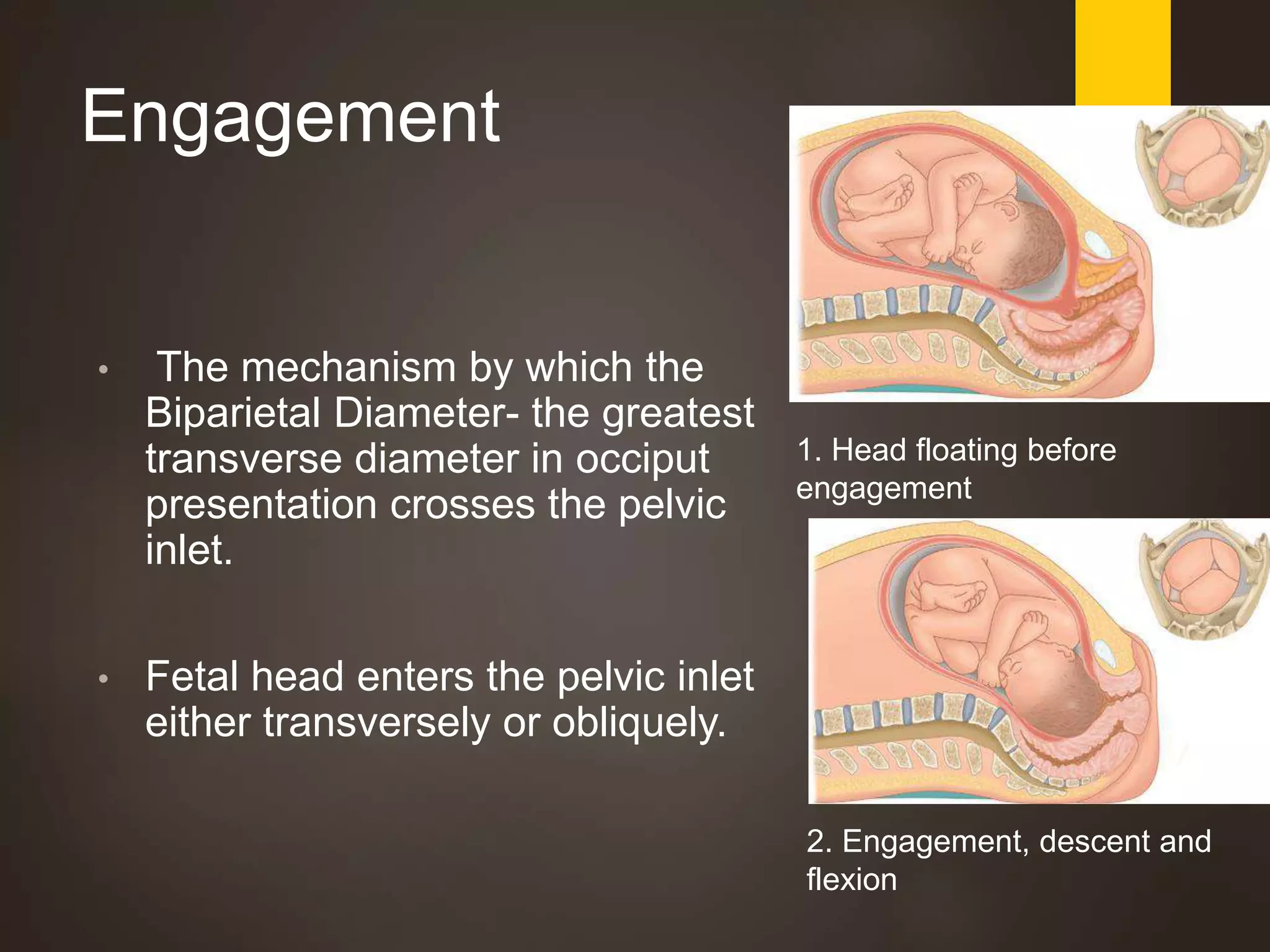 Engagement
• The mechanism by which the
Biparietal Diameter- the greatest
transverse diameter in occiput
presentation crosses the pelvic
inlet.
• Fetal head enters the pelvic inlet
either transversely or obliquely.
1. Head floating before
engagement
2. Engagement, descent and
flexion
 