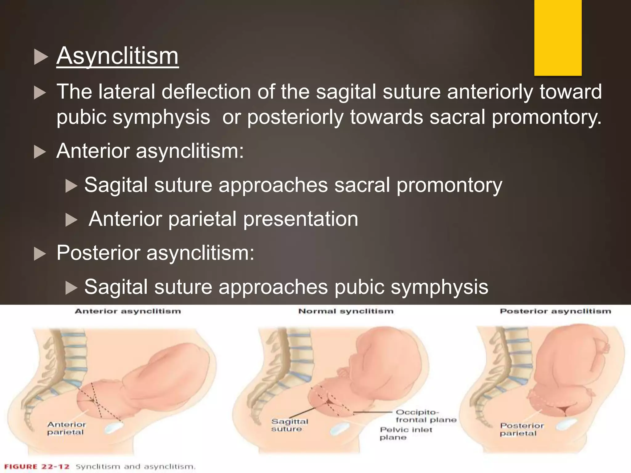  Asynclitism
 The lateral deflection of the sagital suture anteriorly toward
pubic symphysis or posteriorly towards sacral promontory.
 Anterior asynclitism:
 Sagital suture approaches sacral promontory
 Anterior parietal presentation
 Posterior asynclitism:
 Sagital suture approaches pubic symphysis
 Posterior parietal presentation
 
