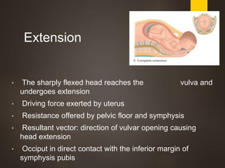 Normal Labor in Obstetrics Slide 46
