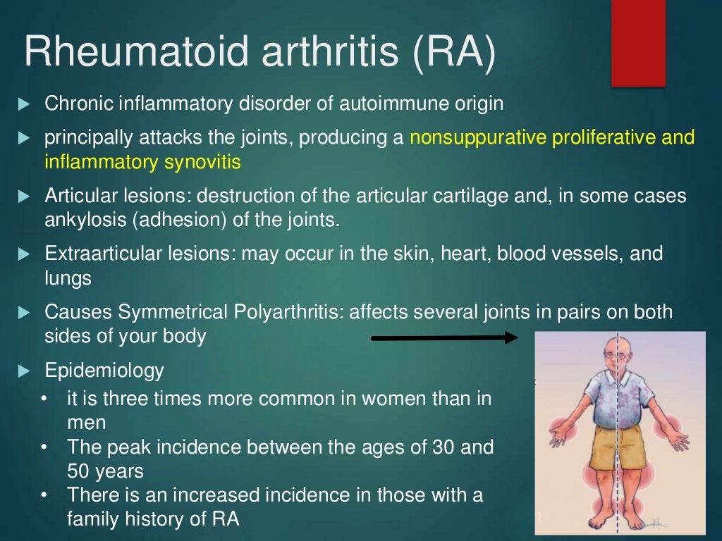 Pathophysiology of Rheumatoid Arthritis