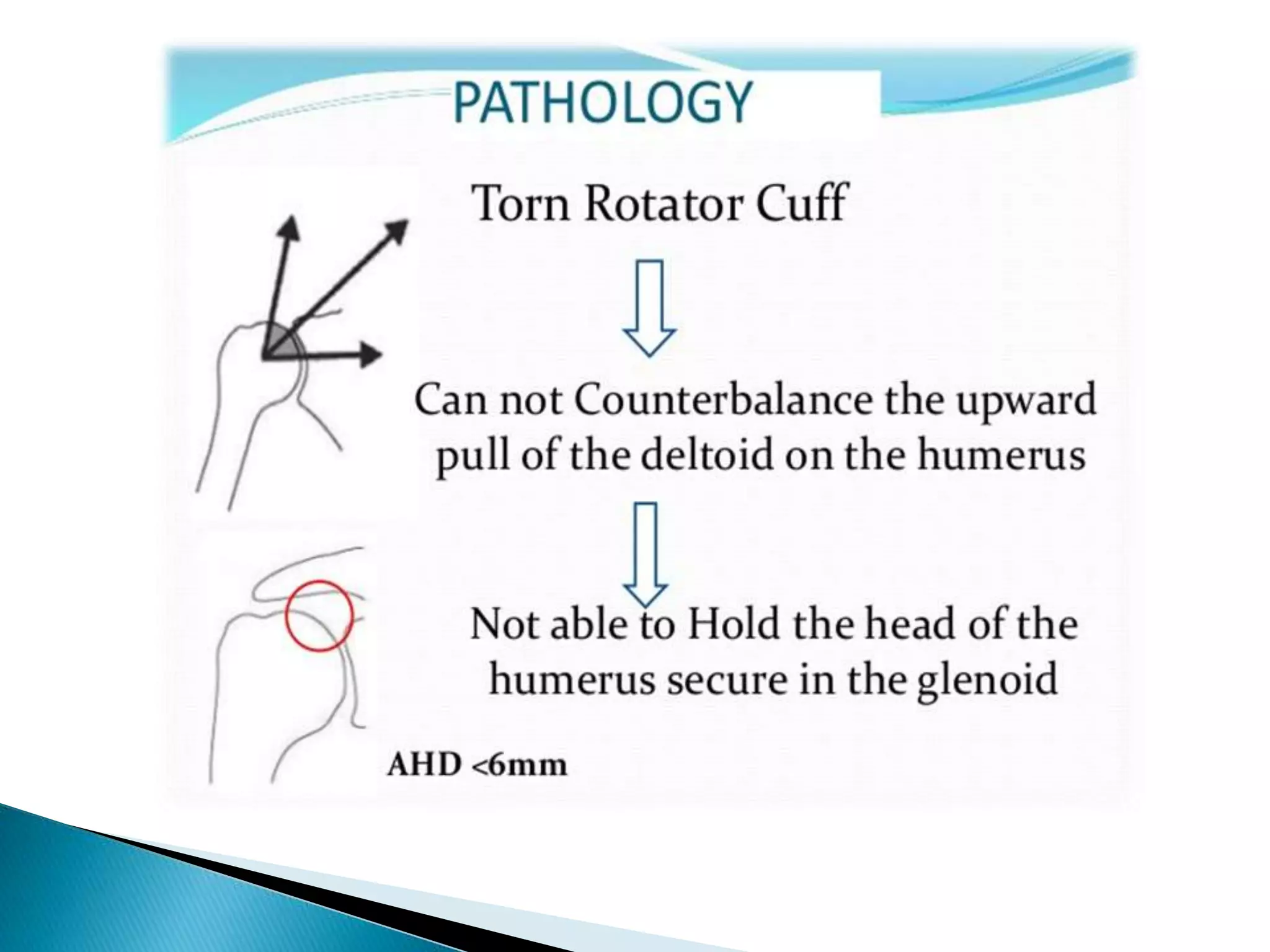 Rotular Instability Pathophysiology of shoulder rotator cuff instability and repair | PPT