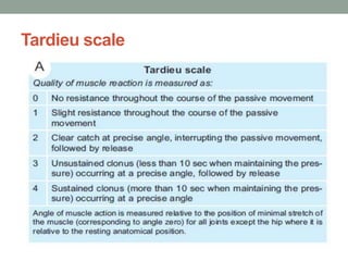 Tardieu scale
 