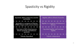 Spasticity vs Rigidity
29
 