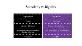 Spasticity vs Rigidity
30
 