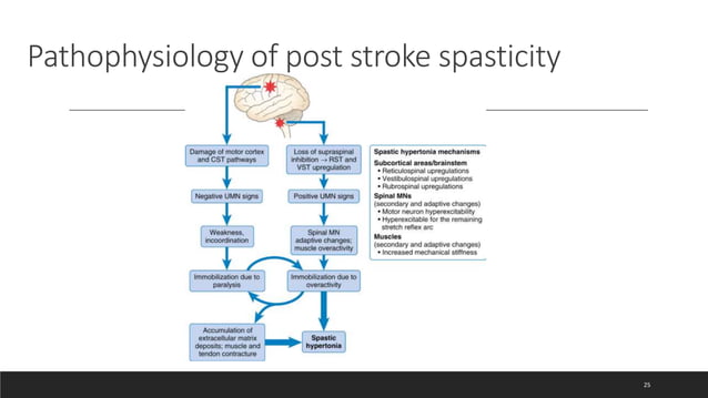 Pathophysiology of Spasticity | PPTX