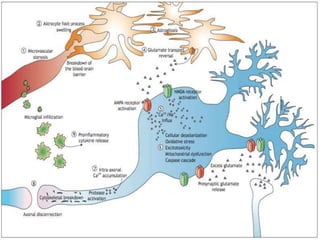 Pathophysiology of traumatic brain injury | PPTX