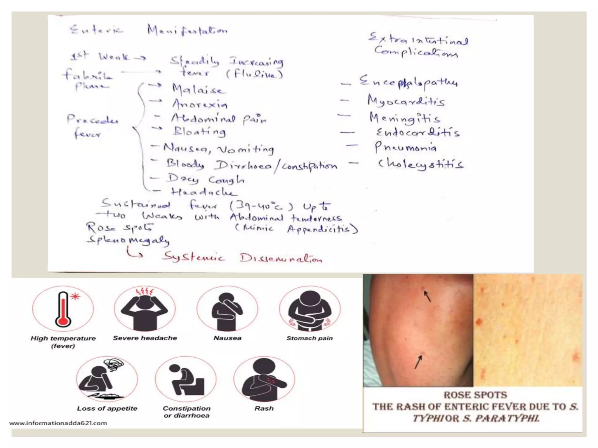 Pathophysiology of typhoid