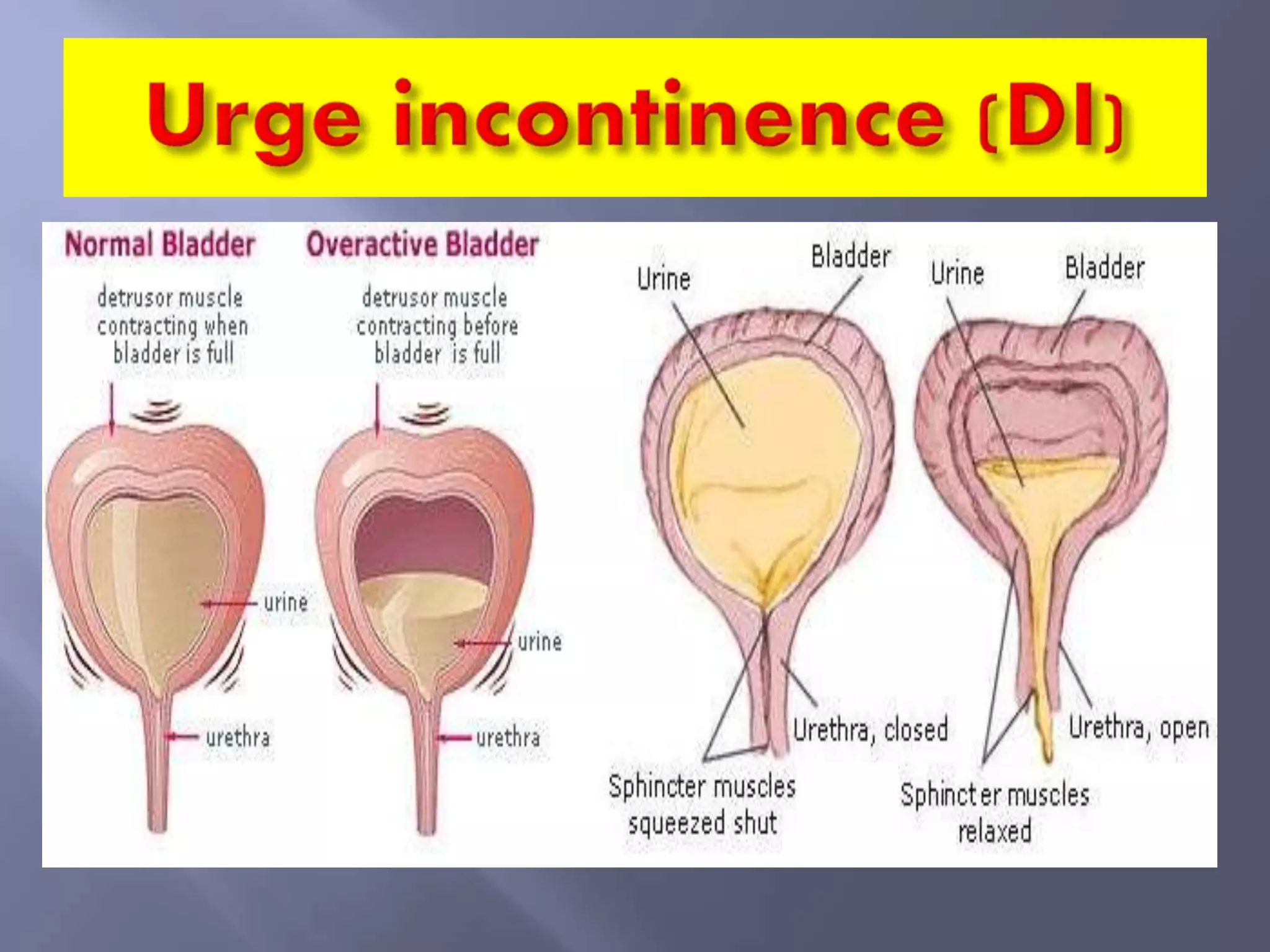 Pathophysiology of urinary incontinence | PPTX