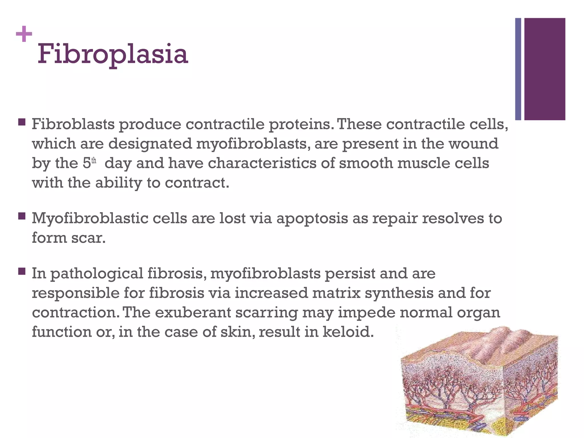 Pathophysiology of wound healing | PPT