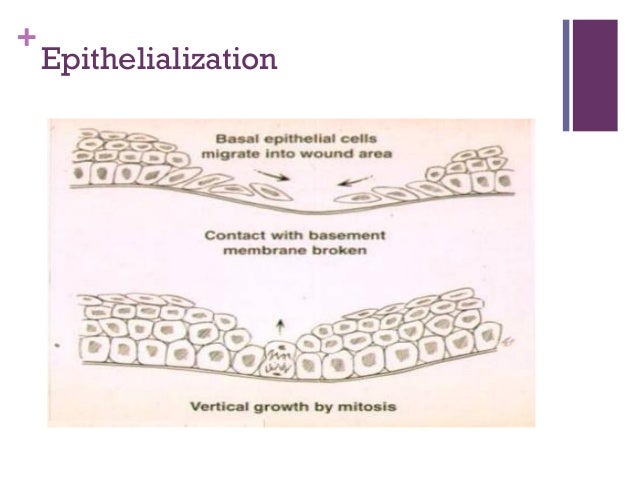 Epithelialization