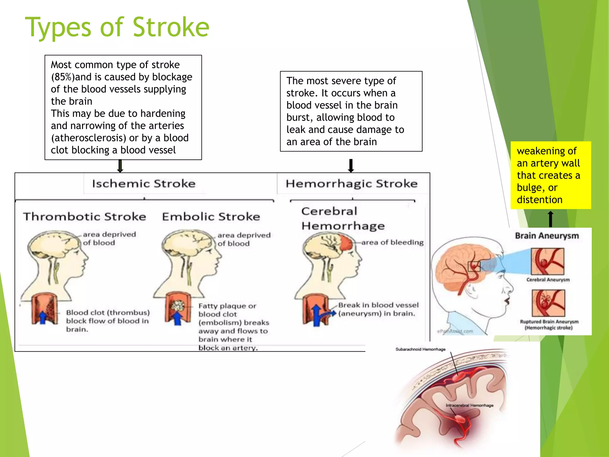 Types of Stroke
Most common type of stroke
(85%)and is caused by blockage
of the blood vessels supplying
the brain
This may be due to hardening
and narrowing of the arteries
(atherosclerosis) or by a blood
clot blocking a blood vessel
The most severe type of
stroke. It occurs when a
blood vessel in the brain
burst, allowing blood to
leak and cause damage to
an area of the brain
weakening of
an artery wall
that creates a
bulge, or
distention
 