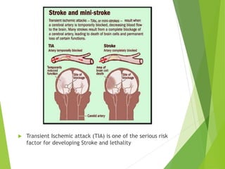  Transient Ischemic attack (TIA) is one of the serious risk
factor for developing Stroke and lethality
 