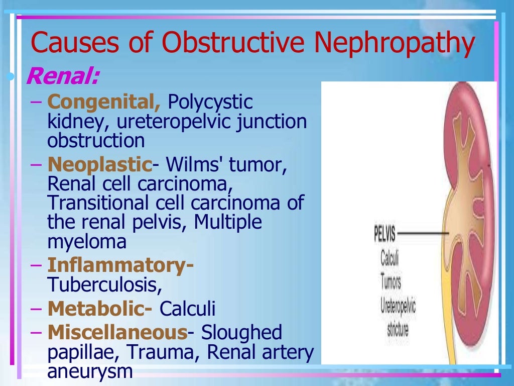 Pathophysioogy of urinary tract obstruction bassem presentation