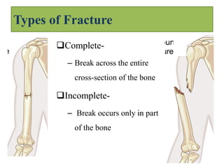 Incomplete Break pathophysiology- terminologies bsc nursing slides notes | PDF