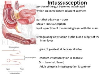 Intersection Intestinal Pathopyshiology of Intestinal Obstruction CHIRANTAN MANDAL Medical ...