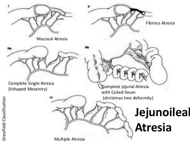pathopyshiology of intestinal obstruction chirantan mandal pathopyshiology of intestinal obstruction chirantan mandal