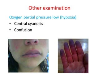 Other examination
Oxygen partial pressure low (hypoxia)
• Central cyanosis
• Confusion