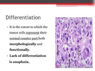 Differentiation
• It is the extent to which the
tumor cells represent their
normal counter part both
morphologically and
functionally.
• Lack of differentiation
is anaplasia.
 