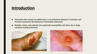 Tularemia | PPT