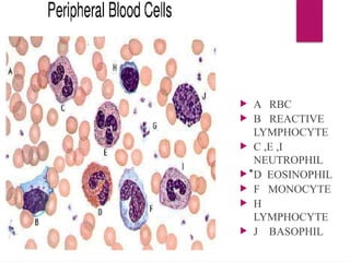  A RBC
 B REACTIVE
LYMPHOCYTE
 C ,E ,I
NEUTROPHIL
 D EOSINOPHIL
 F MONOCYTE
 H
LYMPHOCYTE
 J BASOPHIL
 