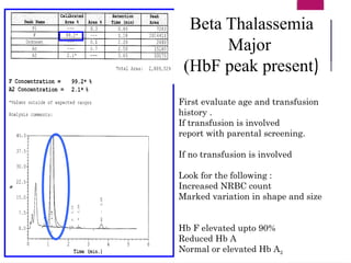 First evaluate age and transfusion
history .
If transfusion is involved
report with parental screening.
If no transfusion is involved
Look for the following :
Increased NRBC count
Marked variation in shape and size
Hb F elevated upto 90%
Reduced Hb A
Normal or elevated Hb A2
Beta Thalassemia
Major
(HbF peak present)
 