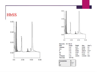 HbSS
 