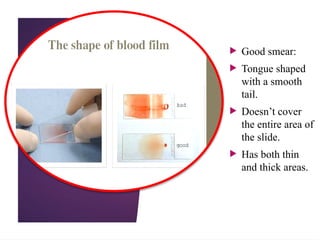  Good smear:
 Tongue shaped
with a smooth
tail.
 Doesn’t cover
the entire area of
the slide.
 Has both thin
and thick areas.
 