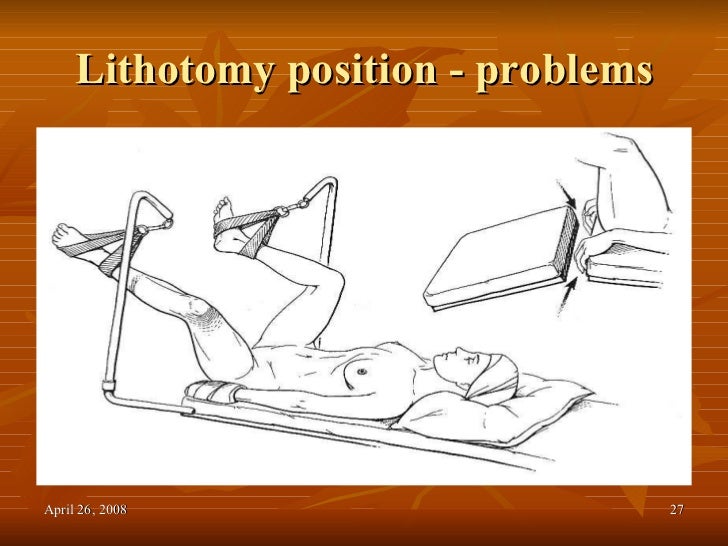 Patient Positioning
