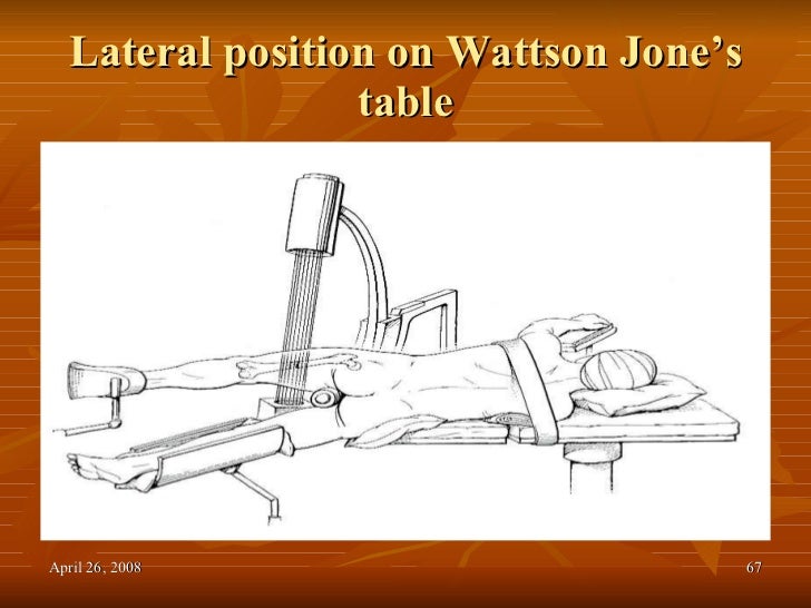 lateral position definition