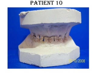 patient 10
 