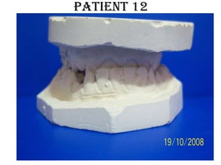 Patient 12
 