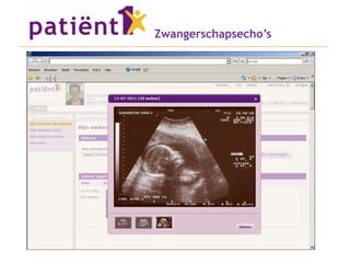 Zwangerschapsecho’s
 