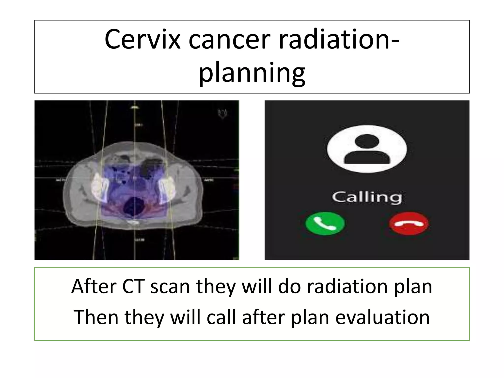 Patient advice during cervix cancer radiation.pptx